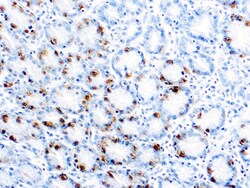 Diagnostic Biosystems GASTRIN Gastrin, Quantity: Each of 1