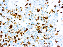 Diagnostic Biosystems GLUT-1 GLUT-1, Quantity: Each of 1