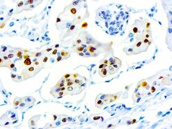 Diagnostic Biosystems CYCLIN D1 Cyclin D1 (SP4), Quantity: Each of 1