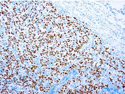Diagnostic Biosystems SOX-10 (MELANOMA MARKER), Quantity: Each of 1