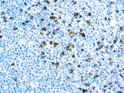 Diagnostic Biosystems CD8 T CELL CD8 (SP16), Quantity: Each of 1