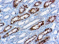 Diagnostic Biosystems EZRIN/P181/CYTOVILLIN Ezrin / p81 / Cytovillin, Quantity: