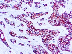 Diagnostic Biosystems CYTOKERATIN CAM52 Cytokeratin (CAM5.2), Quantity: