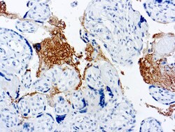 Diagnostic Biosystems THROMBOSPONDIN Caspase 3, Quantity: Each of 1