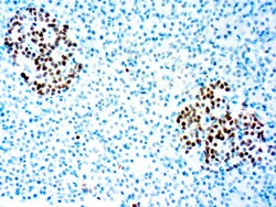 Diagnostic Biosystems&nbsp;INSM1 A-8 INSM1 (A-8)