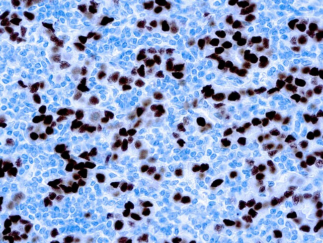 Diagnostic Biosystems PROGESTERONE RECEPTOR (PR), Quantity: Each of 1 ...