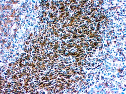 Diagnostic Biosystems HLA DR HLA-DR (β chain of DP, DQ & DR) - RUO, Quantity: