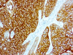 Diagnostic Biosystems CYTOKERATIN 5 AND 14 Cytokeratin 5/14, Quantity: