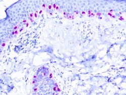 Diagnostic Biosystems MICROPHTHALMIA Microphthalmia Transcription Factor,