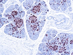Diagnostic Biosystems CHROMOGRANIN A Chromogranin A (SP12), Quantity: Each