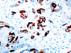 Diagnostic Biosystems MAMMOGLOBIN A Mammaglobin A, Quantity: Each of 1