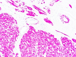 Diagnostic Biosystems ACTIN MUSCLE Actin, Muscle Specific, Quantity: Each