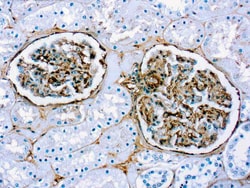 Diagnostic Biosystems FIBRONECTIN Fibronectin