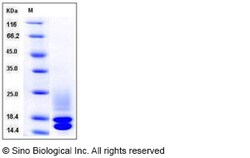 Sino Biological Recombinant Mouse Cystatin C Protein (His Tag), Quantity: