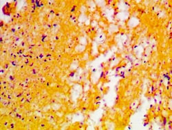 Diagnostic Biosystems GRAM STAIN KIT Gram Stain Kit, Quantity: Each of