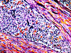 Diagnostic Biosystems&nbsp;PTAH PTAH