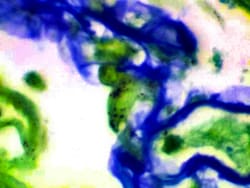Diagnostic Biosystems&nbsp;PNEUMOCYSTIS Pneumocystis