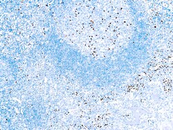 Diagnostic Biosystems&nbsp;MUM1 PROTEIN MUM1 Protein