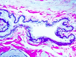 Diagnostic Biosystems&nbsp;ELASTIC Elastic