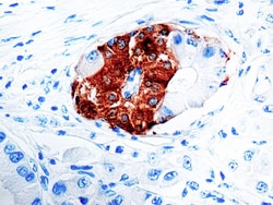 Diagnostic Biosystems&nbsp;SYNAPTOPHYSIN SYP02 Synaptophysin (SYP02)