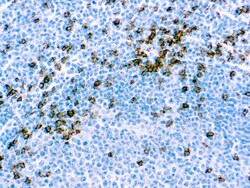 Diagnostic Biosystems&nbsp;CD8 T-CELL CD8 (SP16)