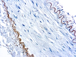 Diagnostic Biosystems&nbsp;ELASTIN Elastin