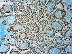 Diagnostic Biosystems&nbsp;VILLIN Villin (1D2C3)