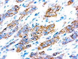Diagnostic Biosystems&nbsp;HER2/NEU C-ERBB-2 c-erbB-2 Oncoprotein (SP3)