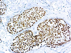 Diagnostic Biosystems&nbsp;GATA3 GATA3