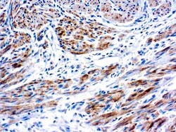 Diagnostic Biosystems&nbsp;CALDESMON Caldesmon