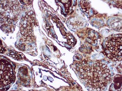 Diagnostic Biosystems&nbsp;THYROGLOBULIN Thyroglobulin (1D4)