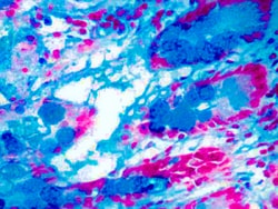 Diagnostic Biosystems&nbsp;ALCIAN BLUE PH 10 Alcian Blue, pH 1.0