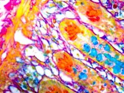 Diagnostic Biosystems&nbsp;COLLOIDAL IRON Colloidal Iron
