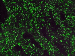 Diagnostic Biosystems&nbsp;KAPPA LIGHT CHAIN-FITC Kappa Light Chain-FITC