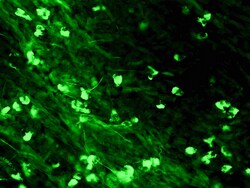 Diagnostic Biosystems&nbsp;IGA-FITC IgA-FITC