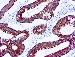 Diagnostic Biosystems CYTOKERATIN 18 Cytokeratin 18 (DC10), Quantity: Each
