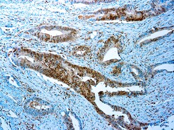Diagnostic Biosystems&nbsp;SMAD4 Smad4
