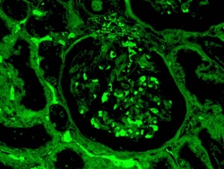 Diagnostic Biosystems&nbsp;C4C-FITC C4c Complement-FITC