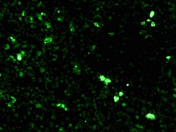 Diagnostic Biosystems C1Q-FITC C1q Complement-FITC, Quantity: Each of 1