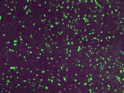 Diagnostic Biosystems&nbsp;LAMBDA LIGHT CHAIN-FITC Lambda Light Chain-FITC