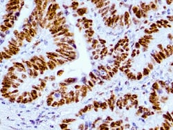 Diagnostic Biosystems&nbsp;MSH6 MSH6