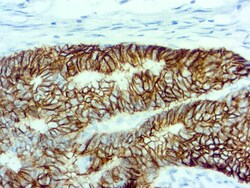 Diagnostic Biosystems CADHERIN 17 Cadherin 17, Quantity: Each of 1