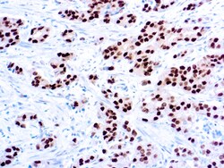 Diagnostic Biosystems ANDROGEN RECEPTOR Androgen Receptor, Quantity: Each