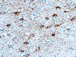 Diagnostic Biosystems&nbsp;GFAP Glial Fibrillary Acidic Protein, GFAP