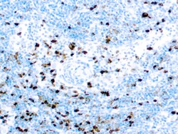 Diagnostic Biosystems MYELOPEROXIDASE Myeloperoxidase, Quantity: Each of