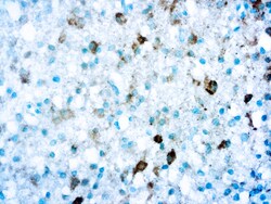 Diagnostic Biosystems&nbsp;ANTI-ISOCITRATE DEHYDROGENENAS Anti-Isocitrate Dehydrogenenase 1 (IDH1)-R132S
