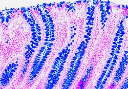 Diagnostic Biosystems&nbsp;ALCIAN BLUE PH 25 Alcian Blue, pH 2.5