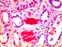 Diagnostic Biosystems AMYLOID Amyloid Stain Kit (Congo Red), Quantity: