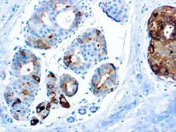 Diagnostic Biosystems&nbsp;GCDFP-15 GCDFP-15
