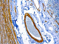 Diagnostic Biosystems&nbsp;SMOOTH MUSCLE MYOSIN Smooth Muscle Myosin (SMMS-1)